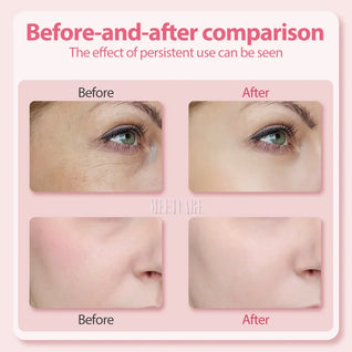 Light Therapy Facial Wand